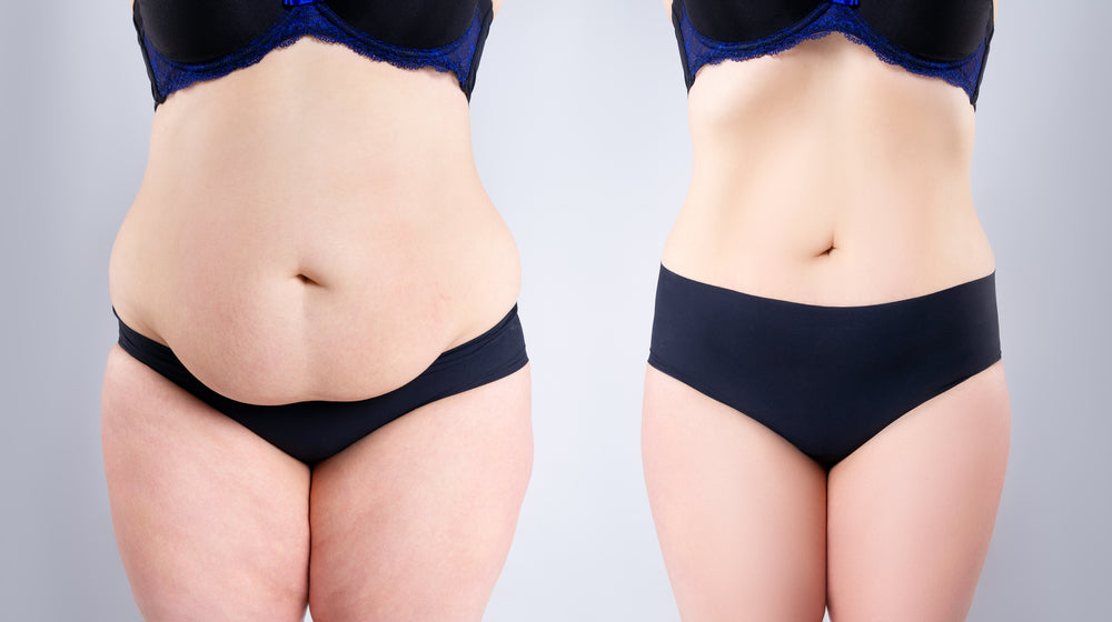 We Found The Best Fajas for Tummy Tuck - Shapewear & More